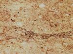 Chiampo Perlato beige Limestone Italy