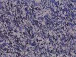 Azul Pegaso Sodalite-syenite Countertops Colors